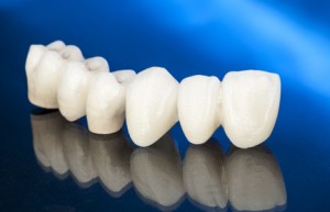 Metal free ceramic dental crowns